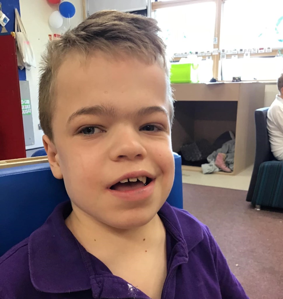 Close up photo of boy with MPS features, smiling and gazing off to the left of the camera. He is in a school setting.